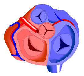 Coronary Artery Fistula