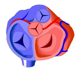 Dextrocardia